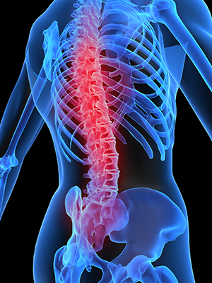 Acute Spinal Injury