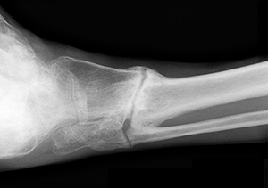 Non Unions Non Unions